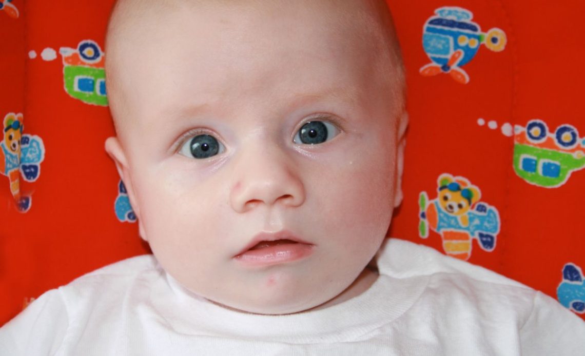 Czerwone policzki u niemowlaka